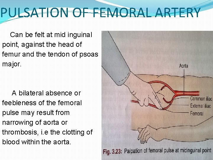 PULSATION OF FEMORAL ARTERY Can be felt at mid inguinal point, against the head