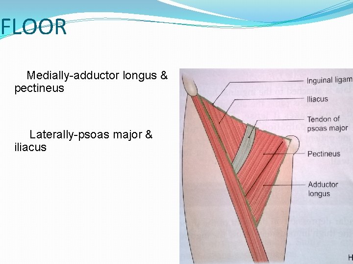 FLOOR Medially-adductor longus & pectineus Laterally-psoas major & iliacus 