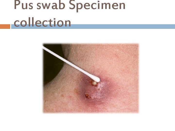 Pus swab Specimen collection 