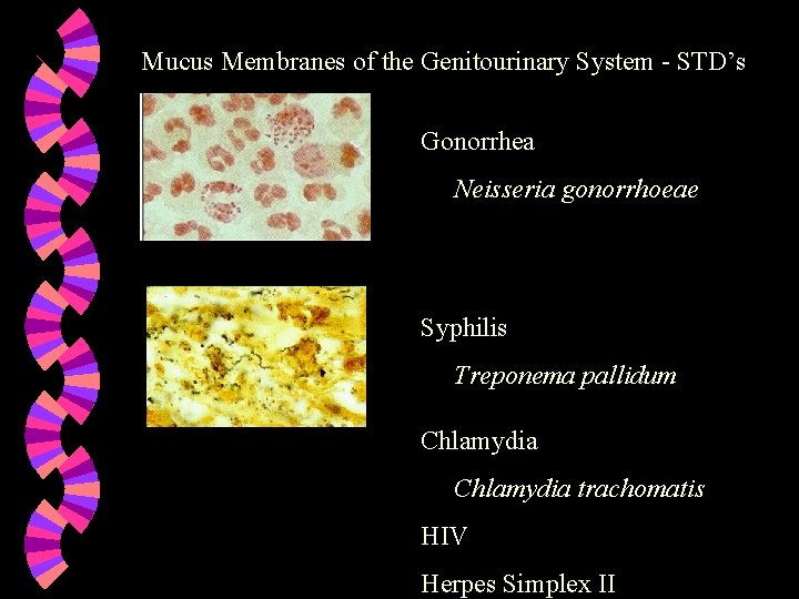 Mucus Membranes of the Genitourinary System - STD’s Gonorrhea Neisseria gonorrhoeae Syphilis Treponema pallidum