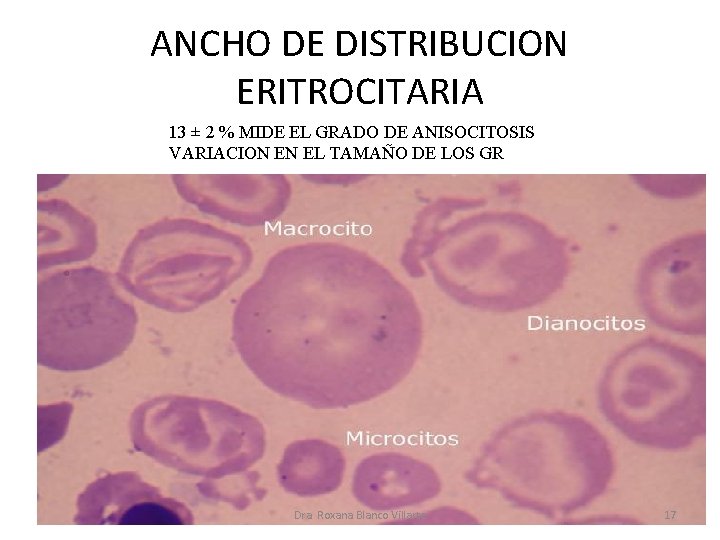 ANCHO DE DISTRIBUCION ERITROCITARIA 13 ± 2 % MIDE EL GRADO DE ANISOCITOSIS VARIACION