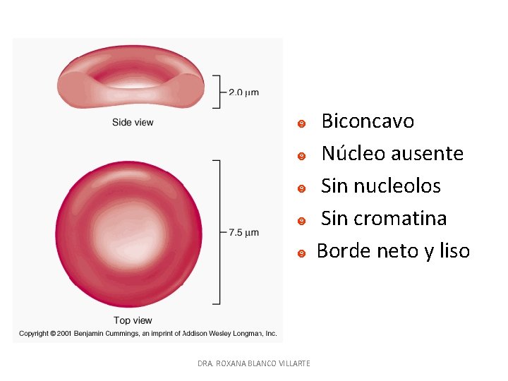 DRA. ROXANA BLANCO VILLARTE Biconcavo Núcleo ausente Sin nucleolos Sin cromatina Borde neto