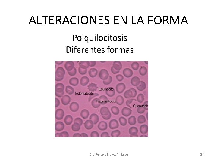 ALTERACIONES EN LA FORMA Dra Roxana Blanco Villarte 34 