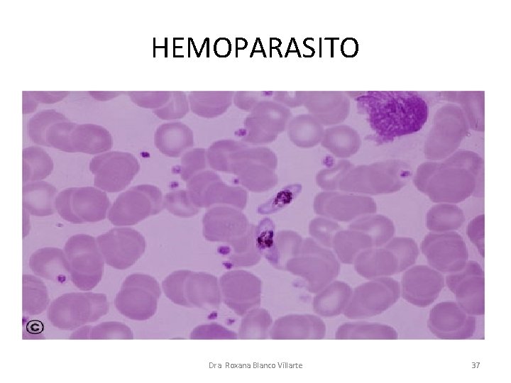 HEMOPARASITO Dra. Roxana Blanco Villarte 37 
