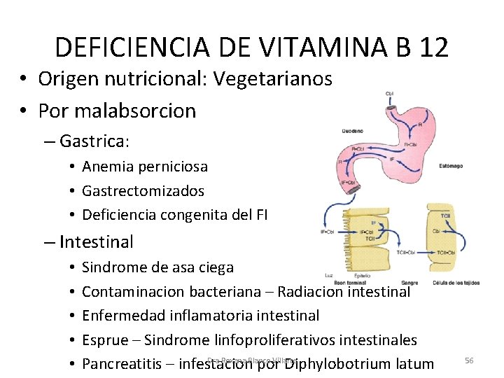 DEFICIENCIA DE VITAMINA B 12 • Origen nutricional: Vegetarianos • Por malabsorcion – Gastrica: