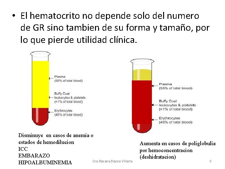  • El hematocrito no depende solo del numero de GR sino tambien de