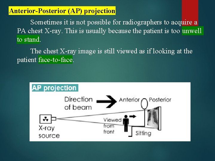 Anterior-Posterior (AP) projection Sometimes it is not possible for radiographers to acquire a PA