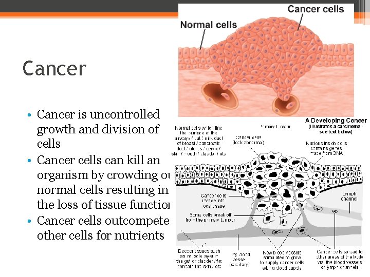 Cancer • Cancer is uncontrolled growth and division of cells • Cancer cells can