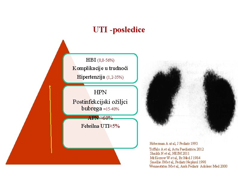 UTI -posledice HBI (0, 0 -56%) Komplikacije u trudnoći Hipertenzija (1, 2 -35%) HPN