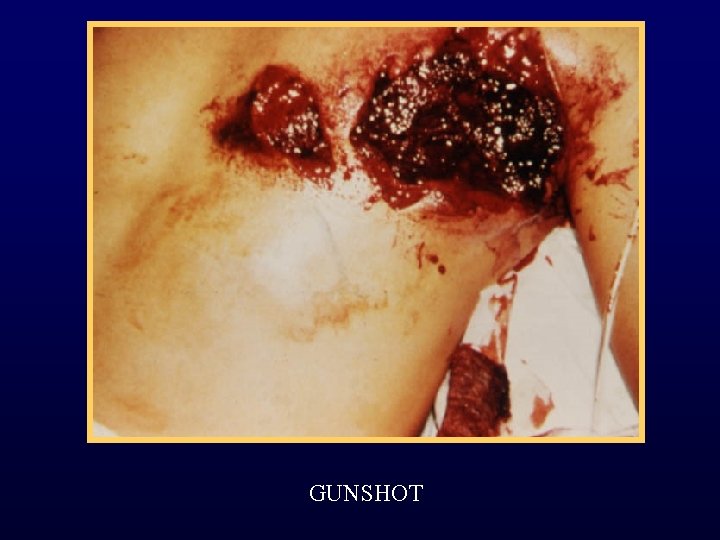 GUNSHOT 