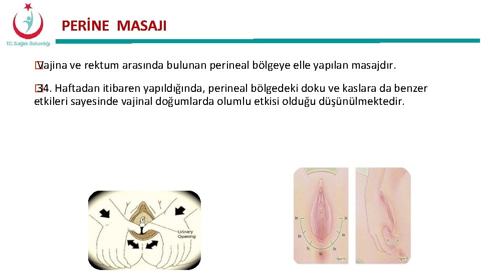 PERİNE MASAJI � Vajina ve rektum arasında bulunan perineal bölgeye elle yapılan masajdır. �
