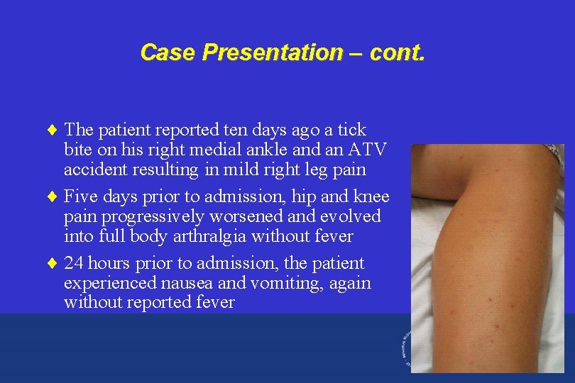 Case Presentation – cont. ¨ The patient reported ten days ago a tick bite