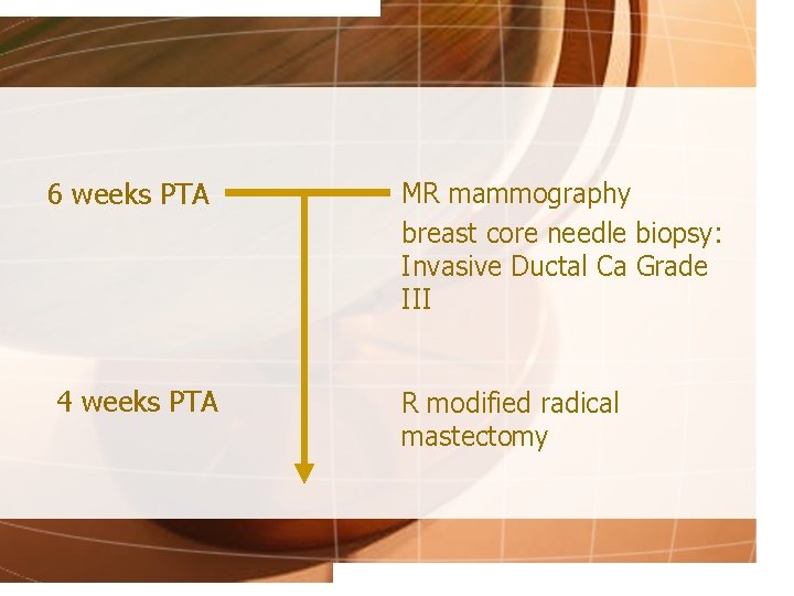 6 weeks PTA 4 weeks PTA MR mammography breast core needle biopsy: Invasive Ductal