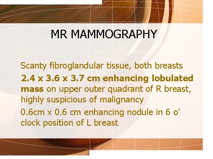 MR MAMMOGRAPHY Scanty fibroglandular tissue, both breasts 2. 4 x 3. 6 x 3.