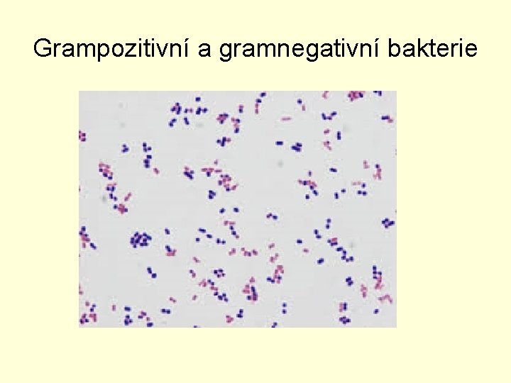 Grampozitivní a gramnegativní bakterie 