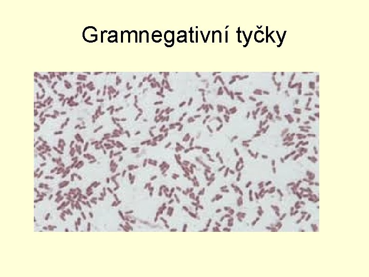 Gramnegativní tyčky 