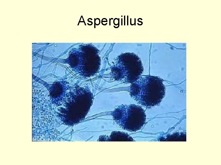 Aspergillus 