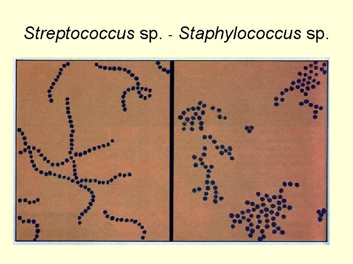 Streptococcus sp. - Staphylococcus sp. 