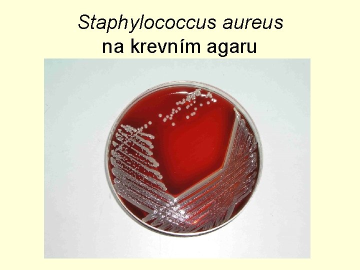 Staphylococcus aureus na krevním agaru 