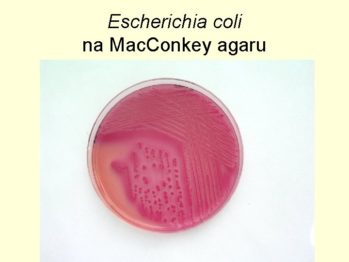 Escherichia coli na Mac. Conkey agaru 