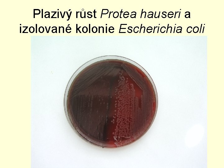 Plazivý růst Protea hauseri a izolované kolonie Escherichia coli 