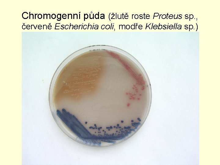 Chromogenní půda (žlutě roste Proteus sp. , červeně Escherichia coli, modře Klebsiella sp. )