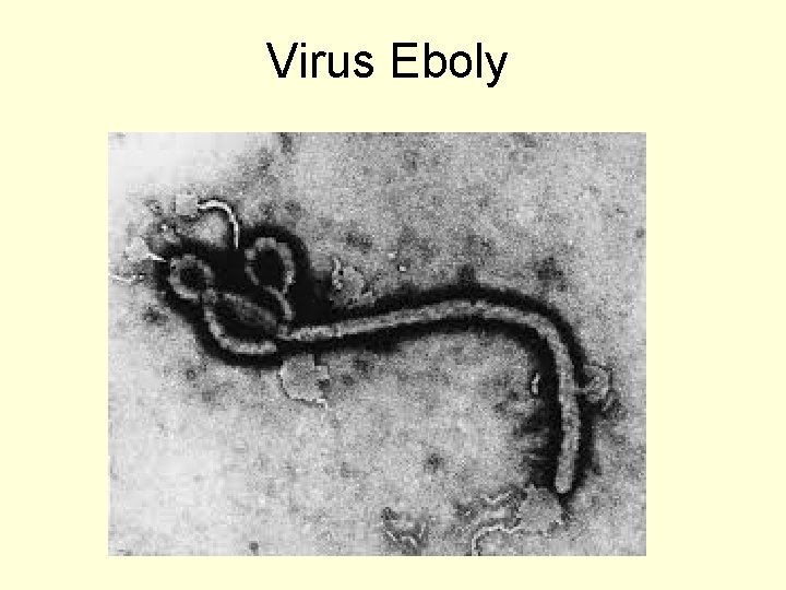 Virus Eboly 