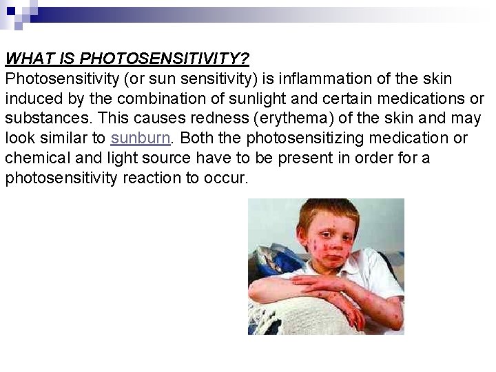 WHAT IS PHOTOSENSITIVITY? Photosensitivity (or sun sensitivity) is inflammation of the skin induced by