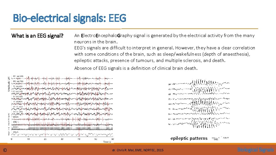 Bio-electrical signals: EEG What is an EEG signal? An Electro. Encephalo. Graphy signal is