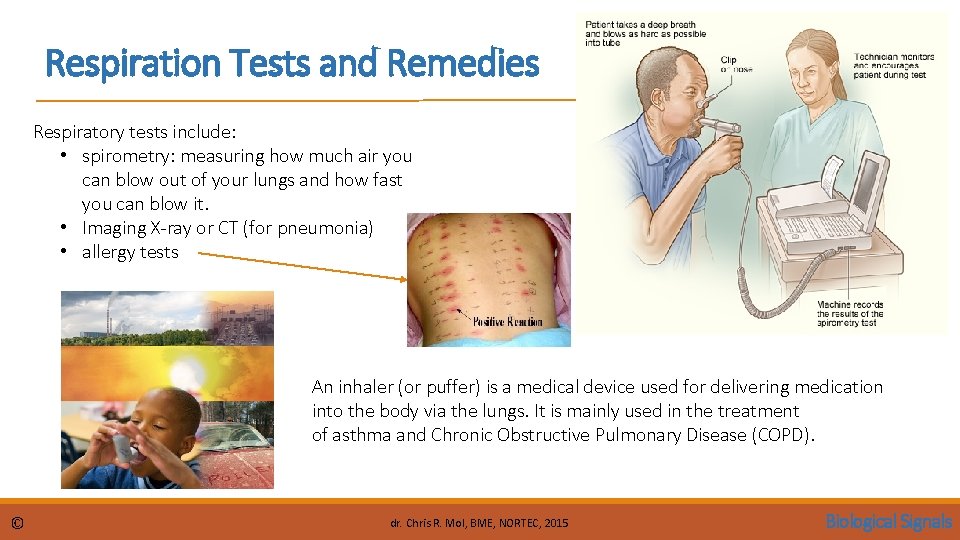 Respiration Tests and Remedies Respiratory tests include: • spirometry: measuring how much air you