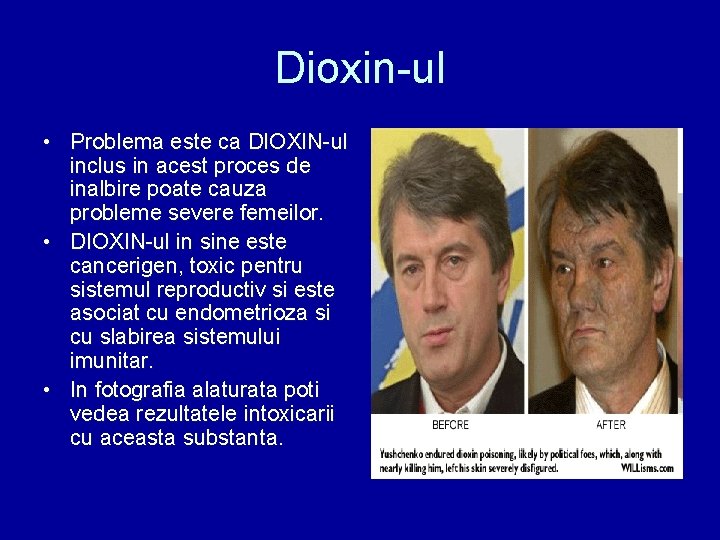 Dioxin-ul • Problema este ca DIOXIN-ul inclus in acest proces de inalbire poate cauza