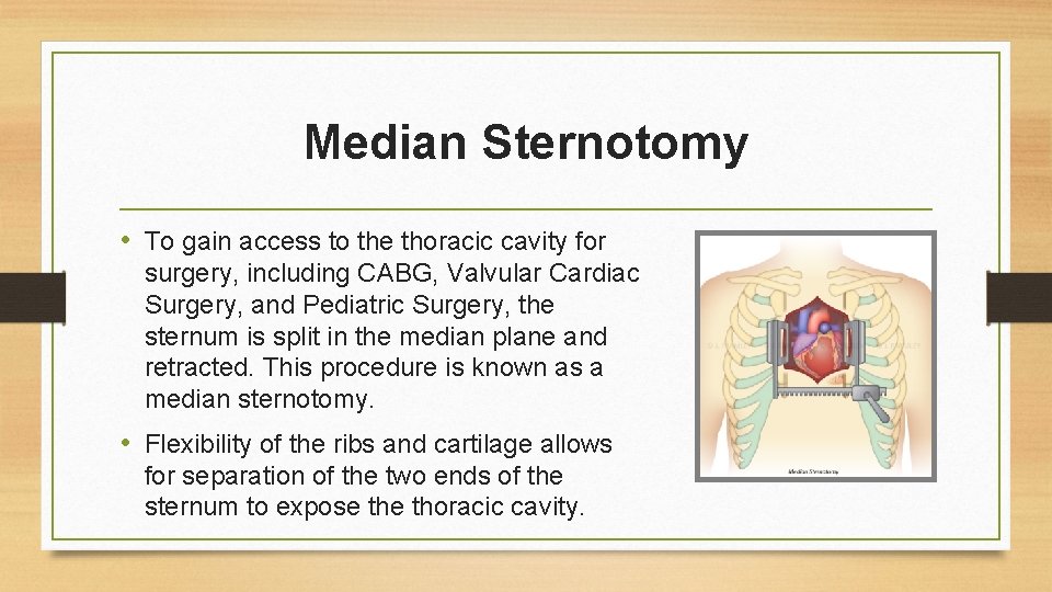 Median Sternotomy • To gain access to the thoracic cavity for surgery, including CABG,