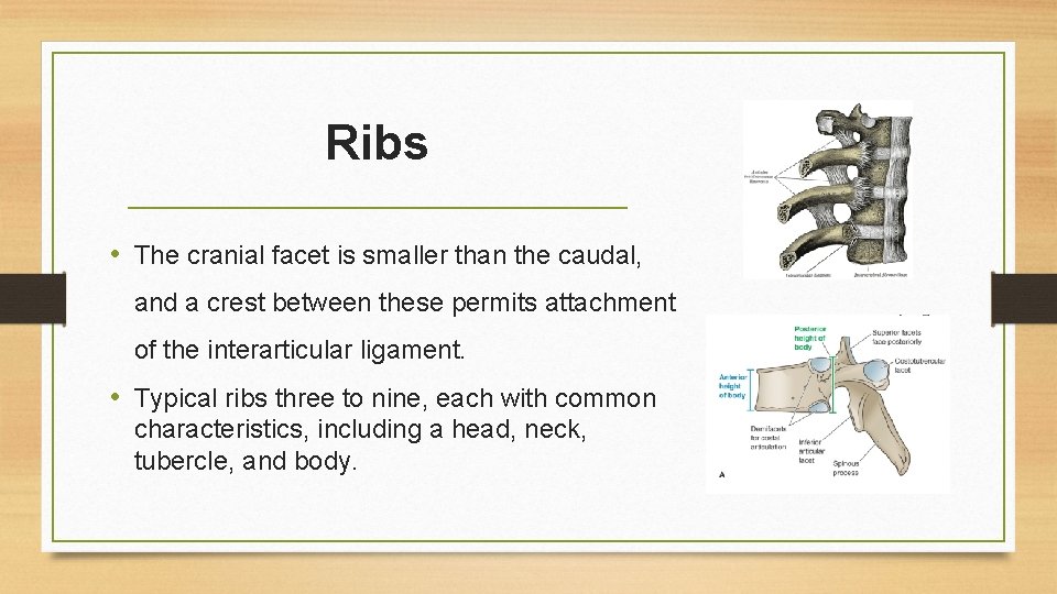 Ribs • The cranial facet is smaller than the caudal, and a crest between