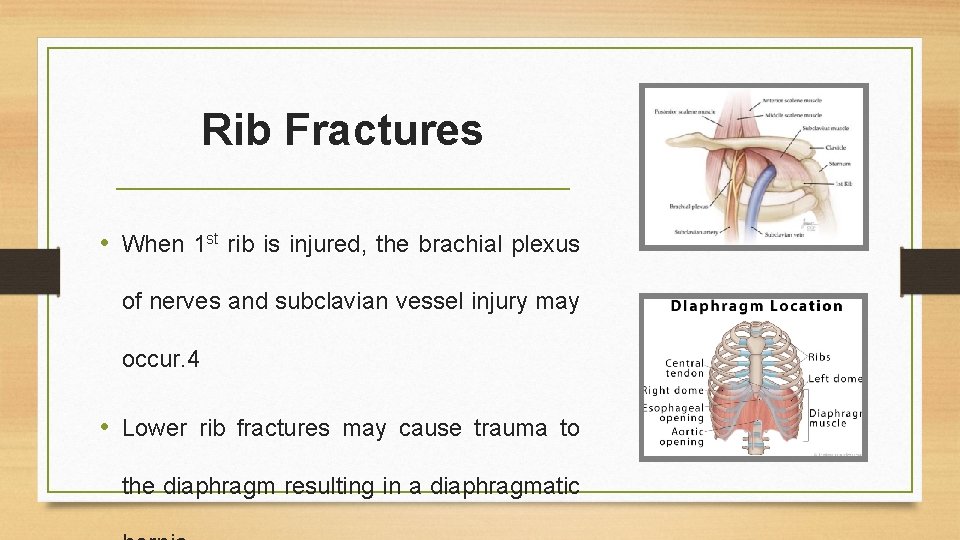 Rib Fractures • When 1 st rib is injured, the brachial plexus of nerves