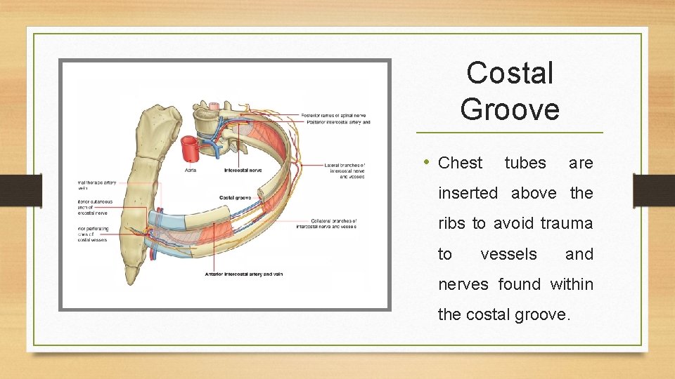 Costal Groove • Chest tubes are inserted above the ribs to avoid trauma to