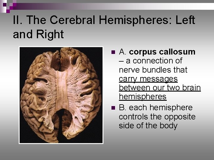 II. The Cerebral Hemispheres: Left and Right n n A. corpus callosum – a