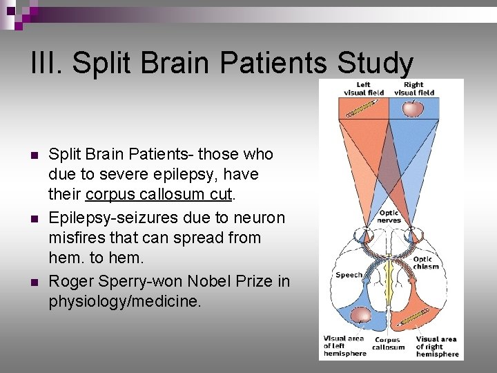 III. Split Brain Patients Study n n n Split Brain Patients- those who due