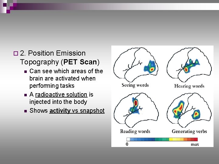 ¨ 2. Position Emission Topography (PET Scan) n n n Can see which areas