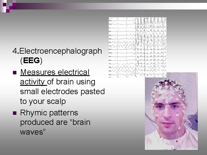 4. Electroencephalograph (EEG) n Measures electrical activity of brain using small electrodes pasted to