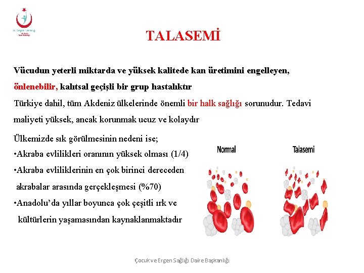 TALASEMİ Vücudun yeterli miktarda ve yüksek kalitede kan üretimini engelleyen, önlenebilir, kalıtsal geçişli bir