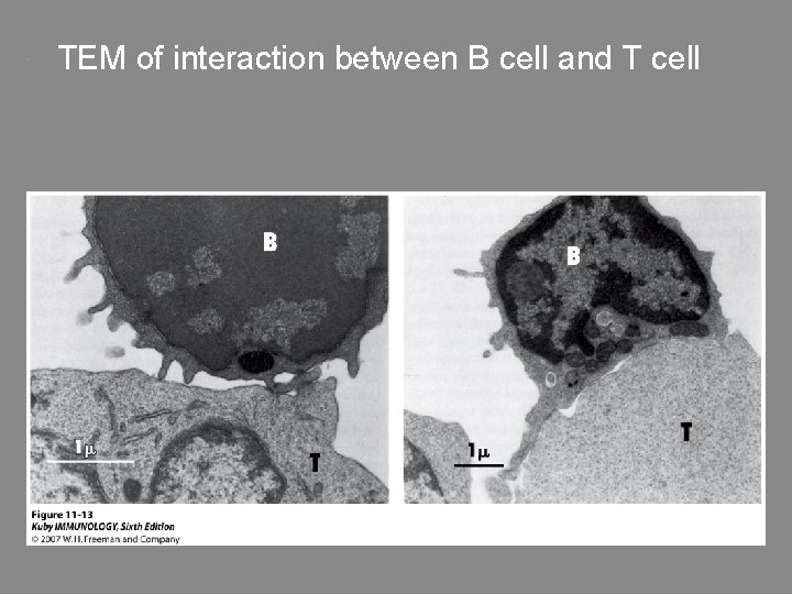  TEM of interaction between B cell and T cell 
