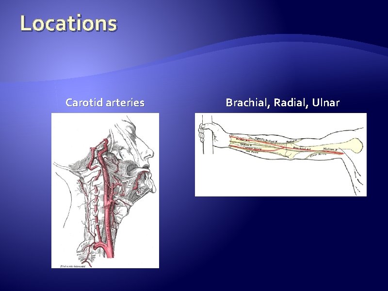 Locations Carotid arteries Brachial, Radial, Ulnar  Locations Carotid arteries Brachial, Radial, Ulnar