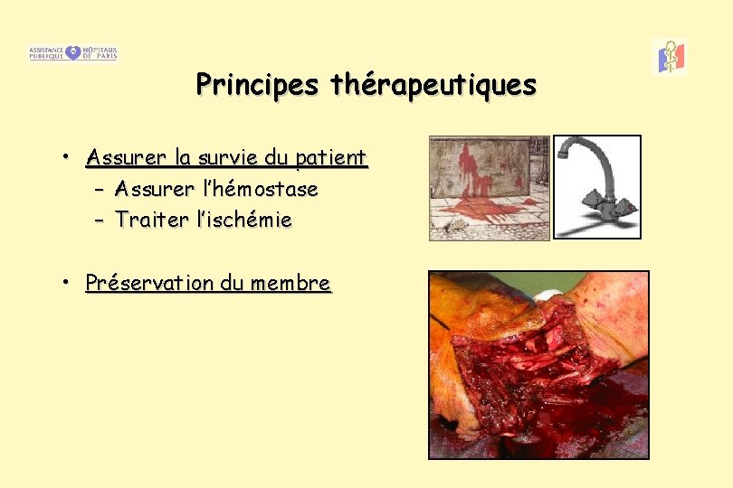 Principes thérapeutiques • Assurer la survie du patient – Assurer l’hémostase – Traiter l’ischémie