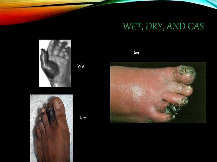 WET, DRY, AND GAS Gas Wet Dry 