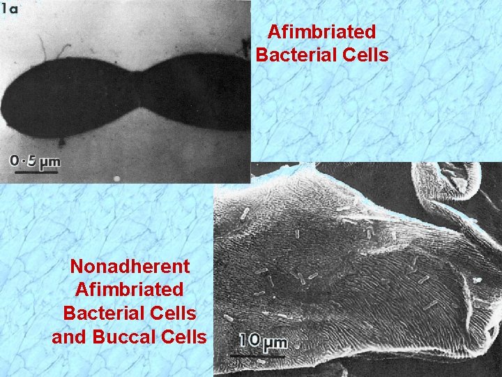Afimbriated Bacterial Cells Nonadherent Afimbriated Bacterial Cells and Buccal Cells 