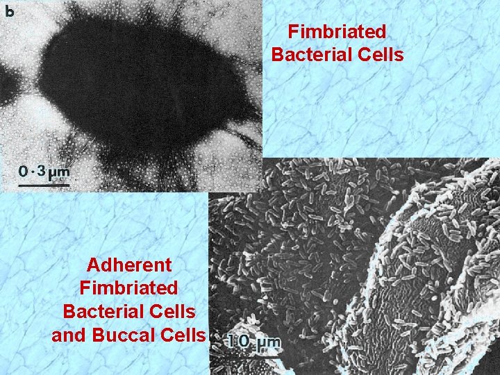 Fimbriated Bacterial Cells Adherent Fimbriated Bacterial Cells and Buccal Cells 