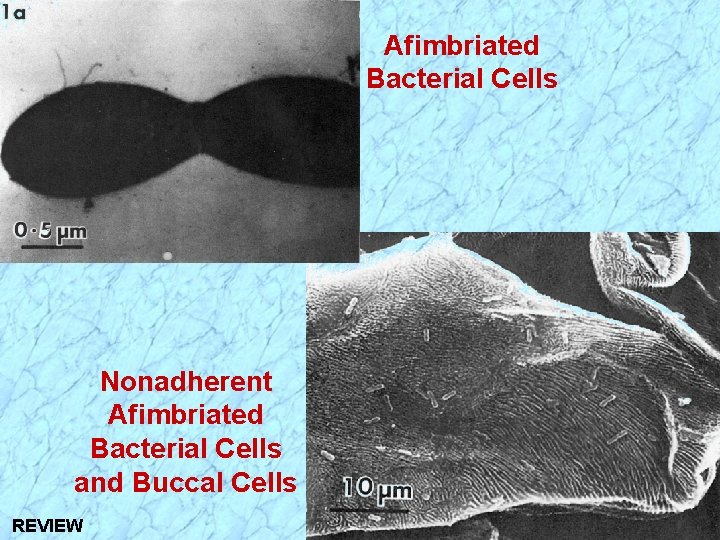 Afimbriated Bacterial Cells Nonadherent Afimbriated Bacterial Cells and Buccal Cells REVIEW 