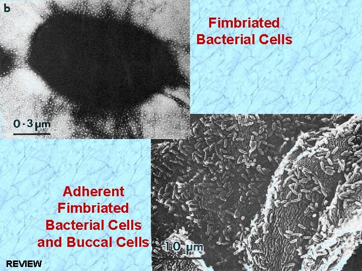 Fimbriated Bacterial Cells Adherent Fimbriated Bacterial Cells and Buccal Cells REVIEW 