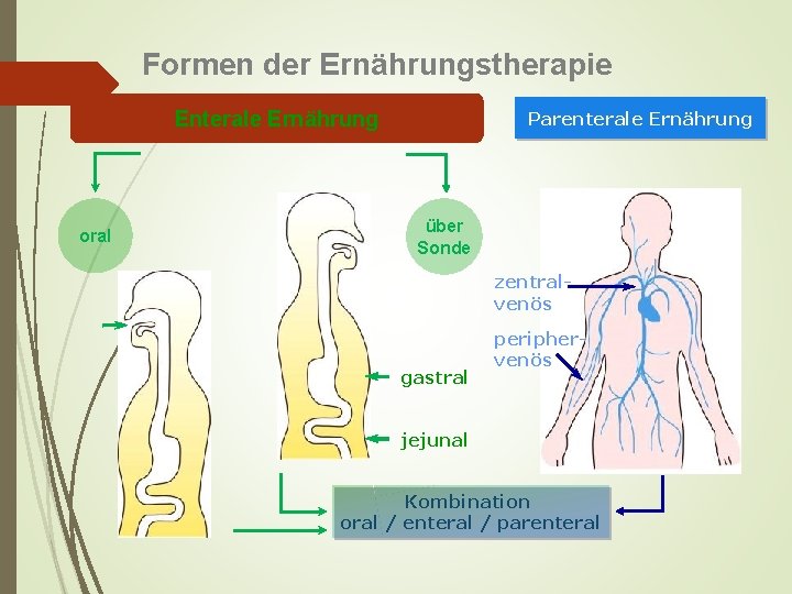 Formen der Ernährungstherapie Enterale Ernährung oral Parenterale Ernährung über Sonde zentralvenös gastral periphervenös jejunal