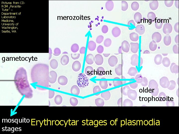 Pictures from CDROM „Parasite. Tutor“ – Department of Laboratory Medicine, University of Washington, Seatle,